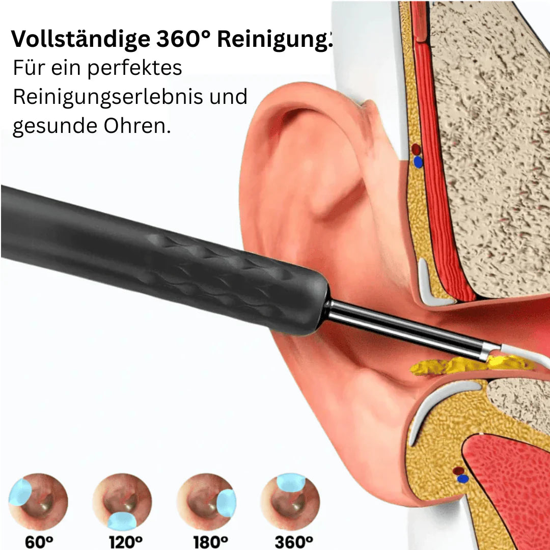 ⏳Begränsad tid 50% rabatt💥Intelligent vattentät visuell öronvaxborttagare