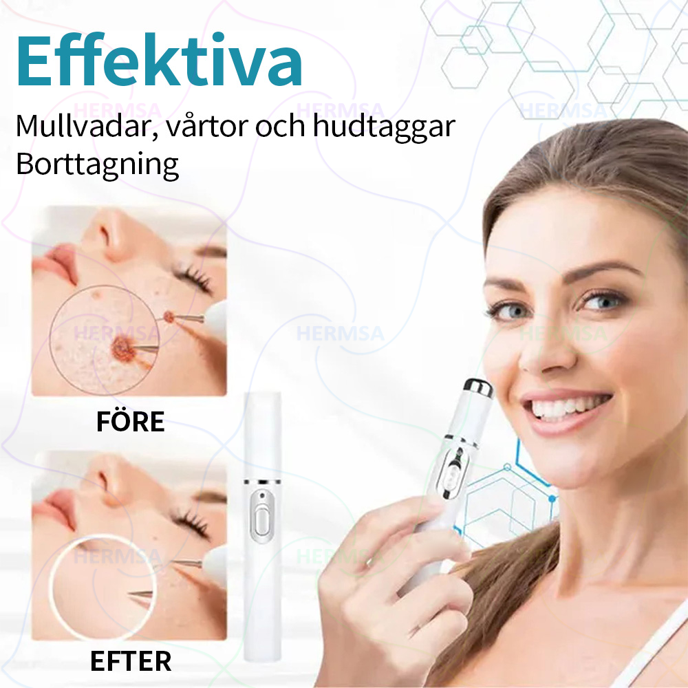 Hermsa® icke-invasiv laserpenna - för borttagning av födelsemärken och vårtor (🔥 Sista dagen - 80% REA)
