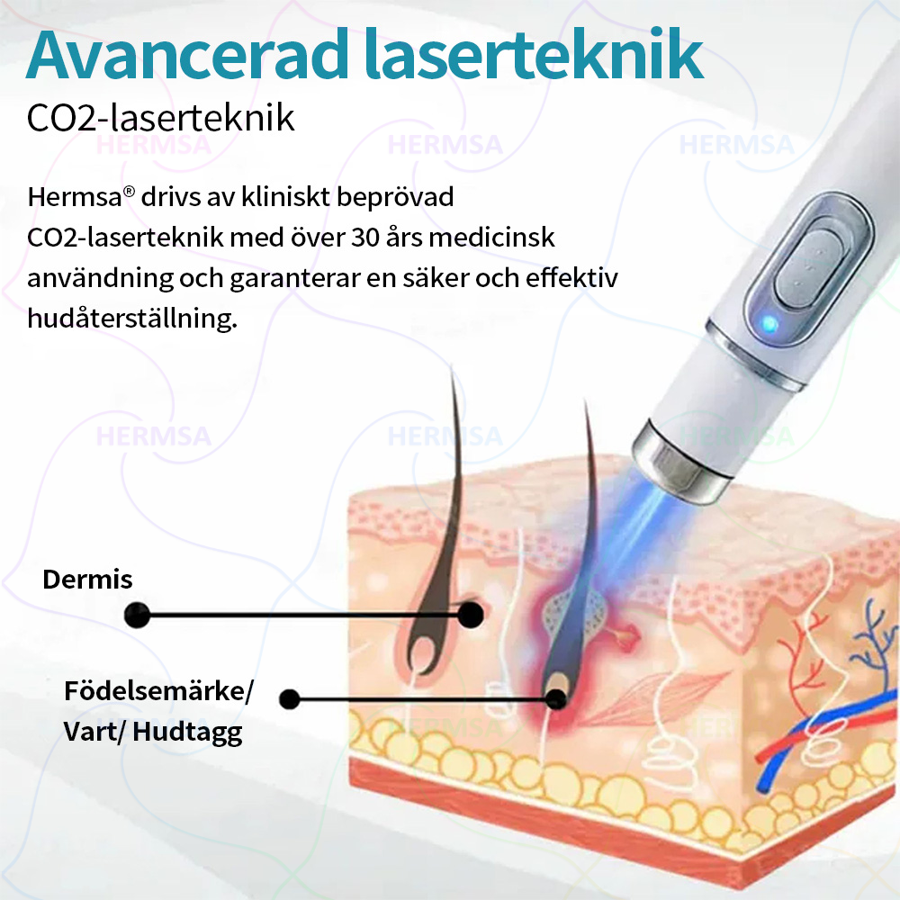 Hermsa® icke-invasiv laserpenna - för borttagning av födelsemärken och vårtor (🔥 Sista dagen - 80% REA)