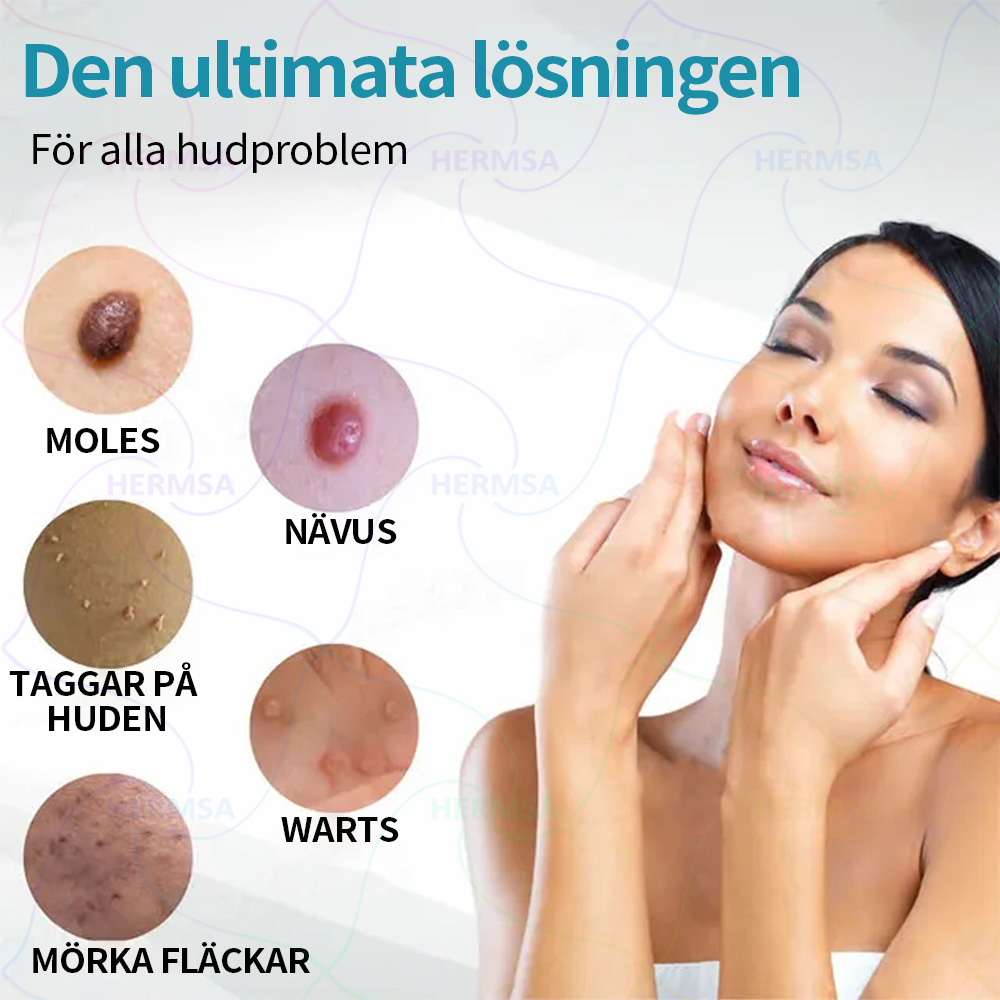 Hermsa® icke-invasiv laserpenna - för borttagning av födelsemärken och vårtor (🔥 Sista dagen - 80% REA)