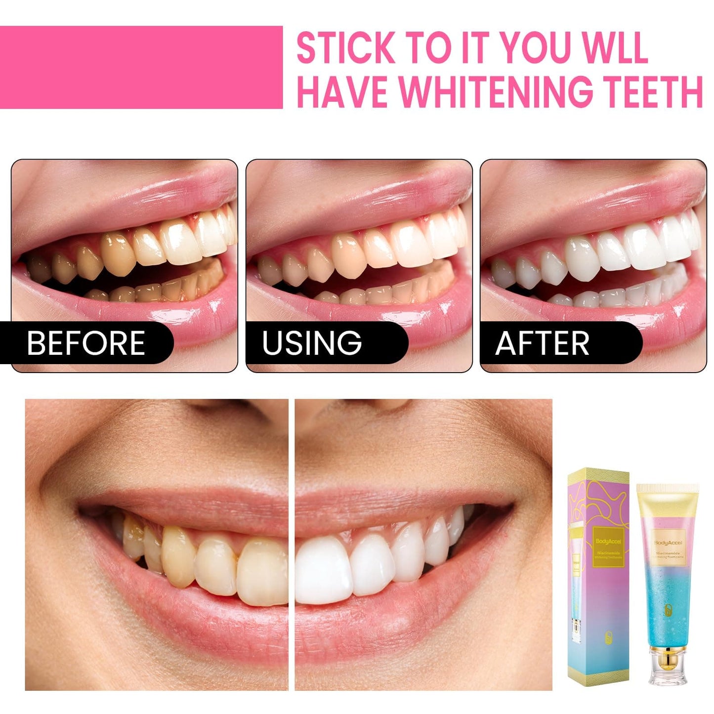 Niacinamide Whitening Tandkräm