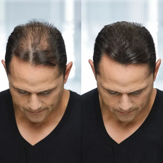 Hårfibrer Hair Toppik©