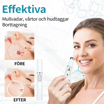 Hermsa® icke-invasiv laserpenna - för borttagning av födelsemärken och vårtor (🔥 Sista dagen - 80% REA)
